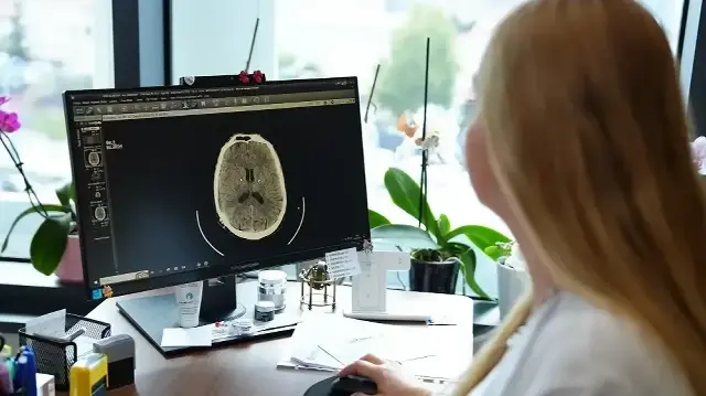 kume bas agrisi nedir belirtileri nelerdir uzmanindan onemli uyarilar O4nPQqkN.webp